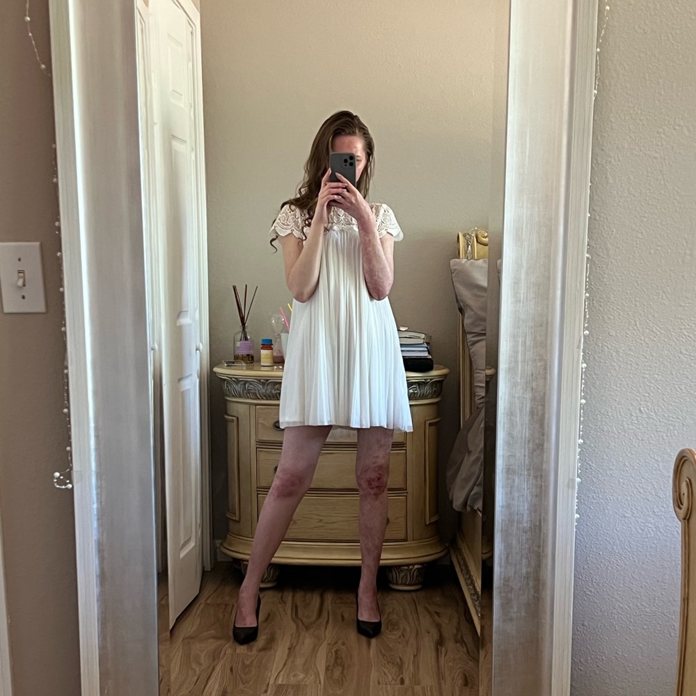 ASOS Rhinestone Lace Dress - Picture 3 of 9